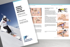 Anterior Approach to Total Hip Replacement