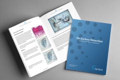 Earlens Retention Brochure