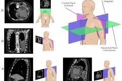 X-Ray Planes
