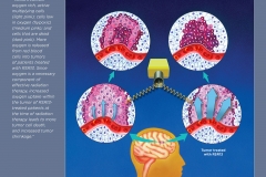 Enhancing Radiation Therapy